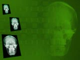 Skull X-ray Medicine PowerPoint Templates