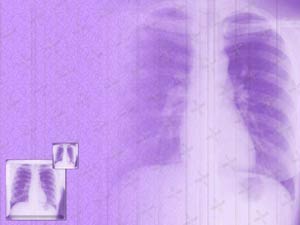 Chest X-ray Title Content PowerPoint Template