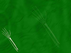 Radius (Forearm Bone) Title Content PowerPoint Template