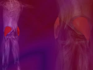 Gluteus Medius Muscle Title Content PowerPoint Template