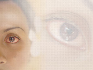 Eye Allergy Title Content PowerPoint Template